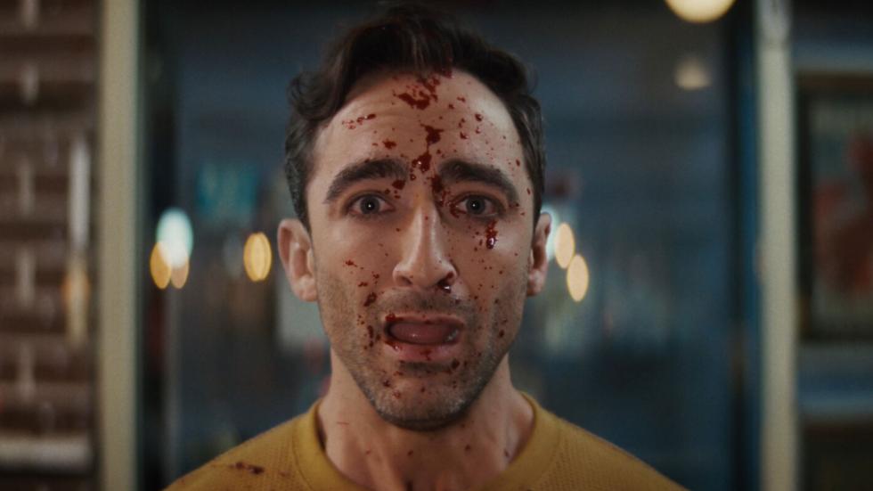 Bloodied faced man
