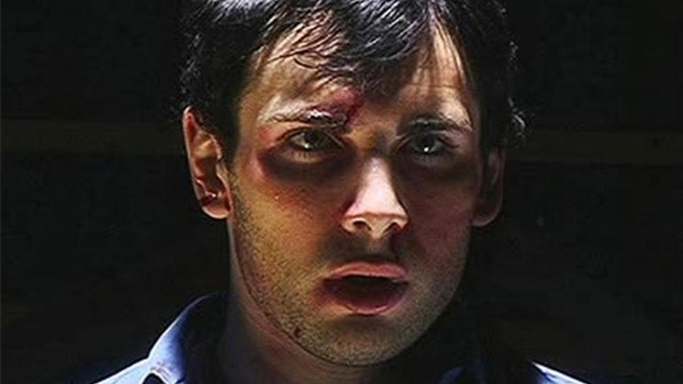 Curve Balls man with blood and bruised face