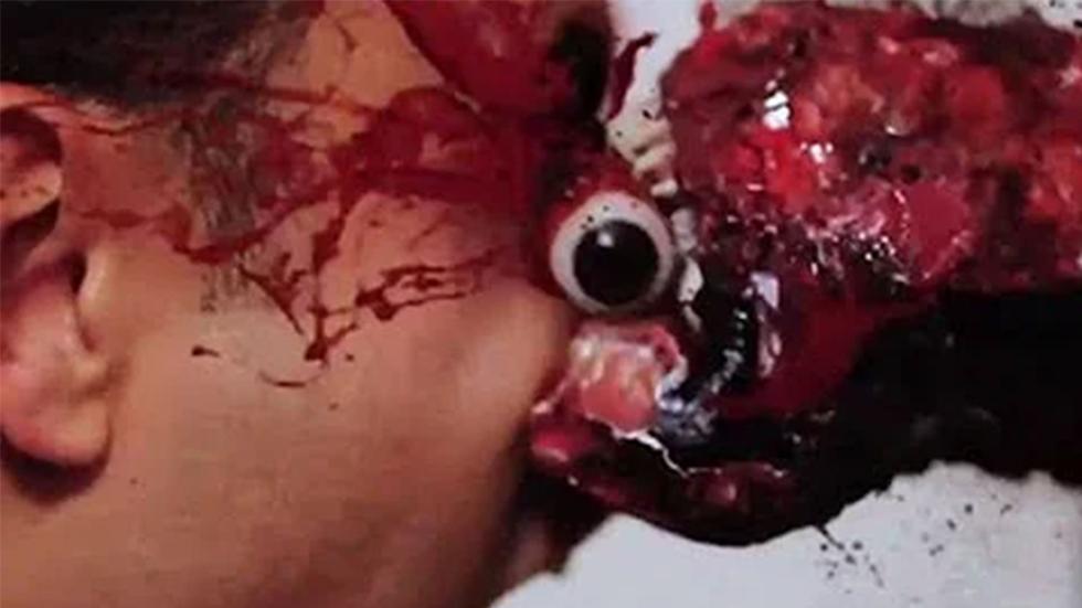 Roid Rage bloody hemroid attacks man's face