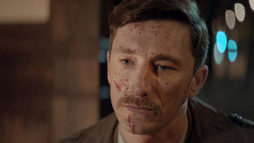The Plague film still bloodied face man