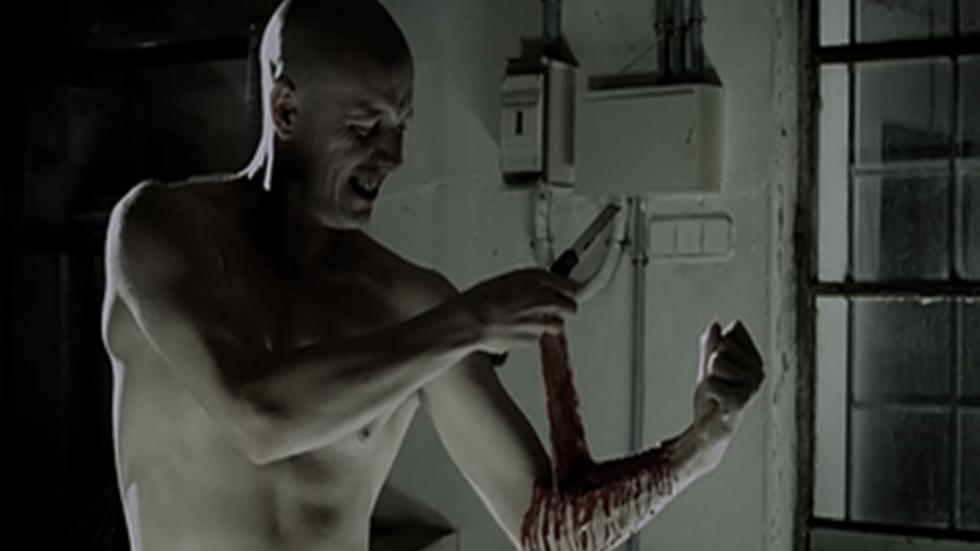 Snip man cuts his arm with bloody results